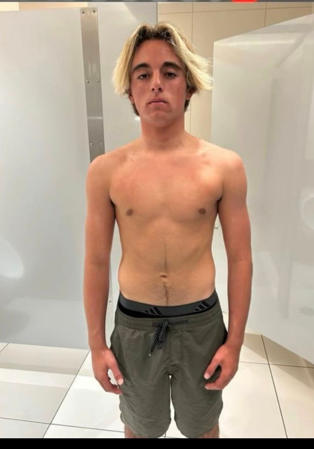 Joey before